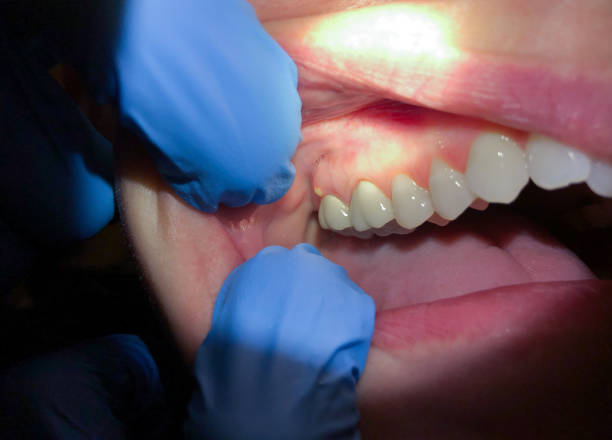 Best Emergency Pediatric Dental Care in Wewa, OK